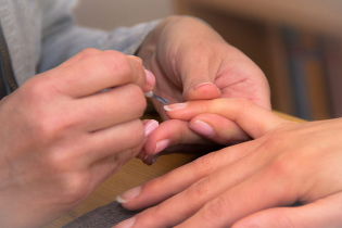 Лечение и профилактика заусенцов на пальцах рук